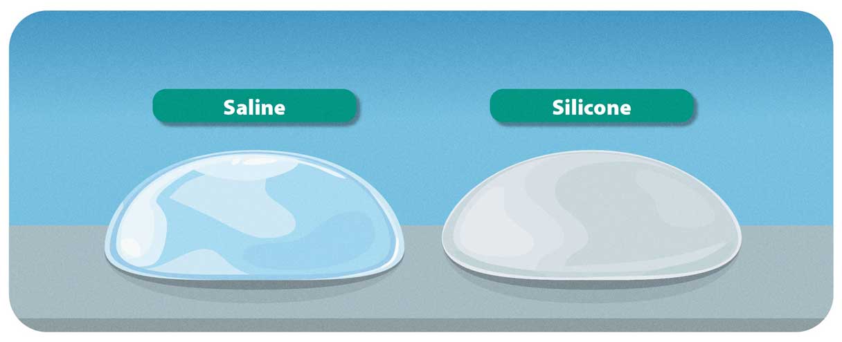 Saline vs. Silicone