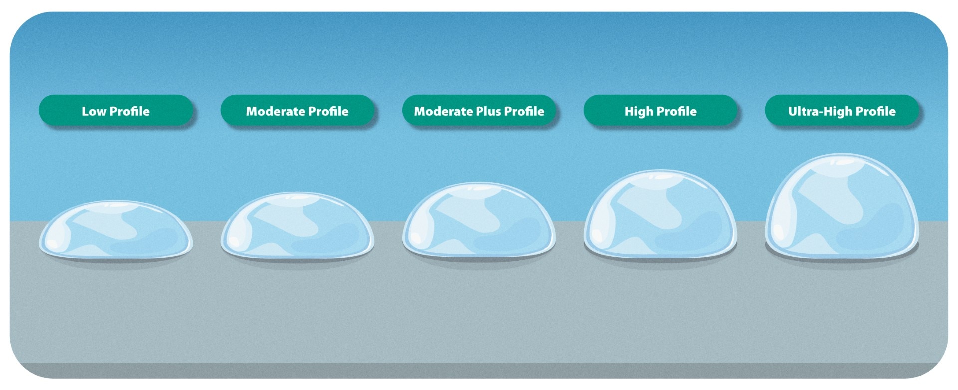 Breast implant profiles