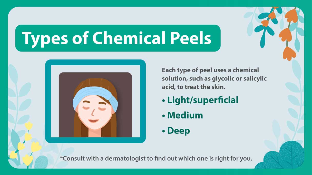 Types of chemical peels