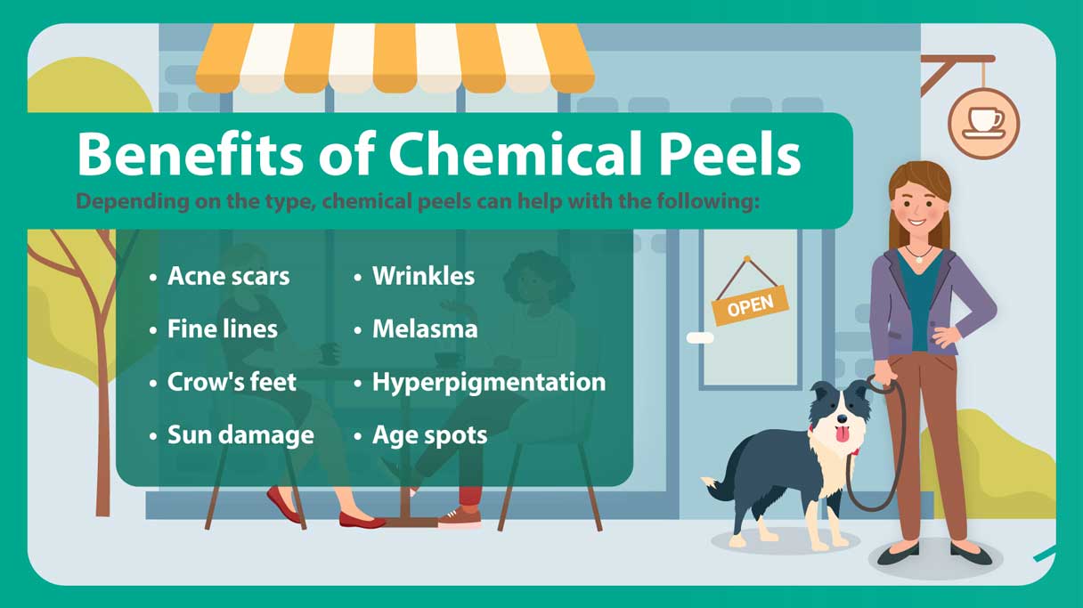 benefits of chemical peels