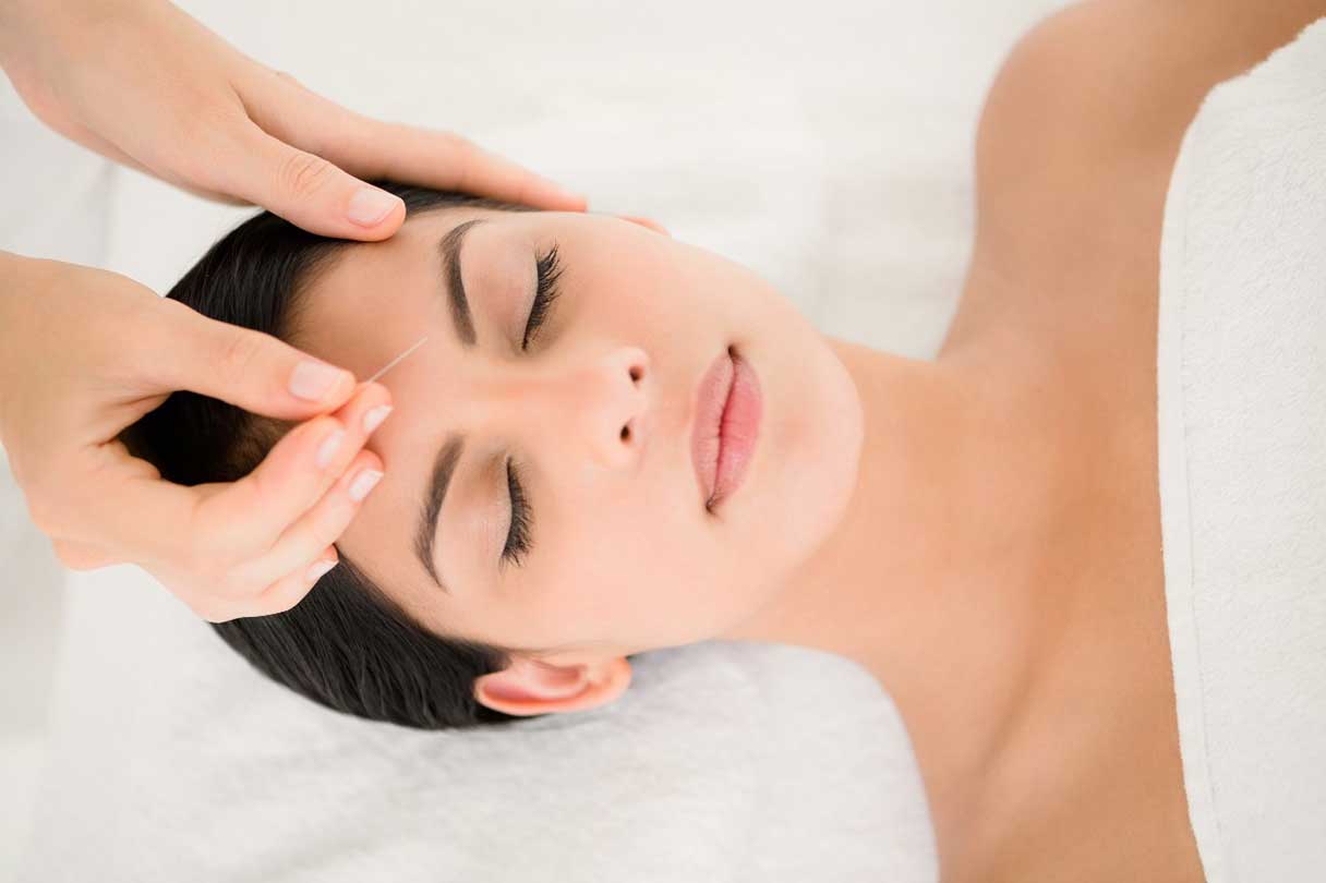 What Is Acupuncture How It Works Treatments And Benefits